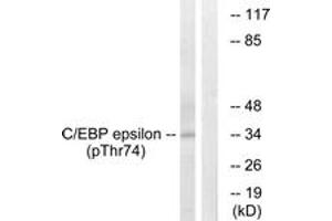 Western blot analysis of extracts from HuvEc cells treated with UV 15', using C/EBP-epsilon (Phospho-Thr74) Antibody.