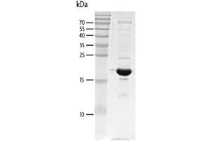 p300 Protein (AA 1041-1161) (His tag,DYKDDDDK Tag)
