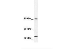 Image no. 3 for anti-RNA Binding Motif Protein 10 (RBM10) (AA 39-88) antibody (ABIN202954)