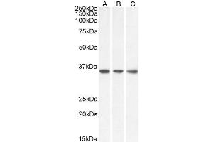 Image no. 3 for anti-Malate Dehydrogenase 2, NAD (Mitochondrial) (MDH2) (Internal Region) antibody (ABIN5539864)