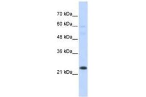 Image no. 1 for anti-TAF12 RNA Polymerase II, TATA Box Binding Protein (TBP)-Associated Factor, 20kDa (TAF12) (N-Term) antibody (ABIN6744413)