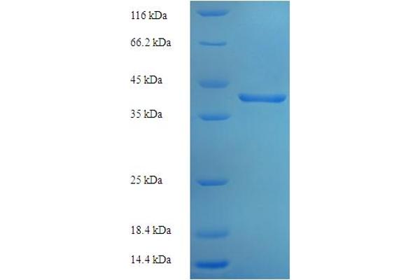 RPP29 Protein (AA 1-220, full length) (His-SUMO Tag)