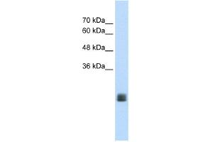 Image no. 1 for anti-Transmembrane Protein 178A (TMEM178A) (Middle Region) antibody (ABIN2775640)