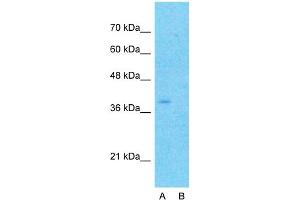 Image no. 3 for anti-Mitochondrially Encoded Cytochrome B (MT-CYB) (N-Term) antibody (ABIN2773962)