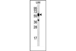 Image no. 1 for anti-Lipase, Family Member M (LIPM) (AA 317-346), (C-Term) antibody (ABIN953185)