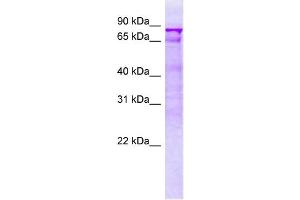 Image no. 2 for Prolyl 4-Hydroxylase, beta Polypeptide (P4HB) protein (ABIN987264)