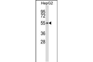 Image no. 1 for anti-WEE1 Homolog 2 (S. Pombe) (WEE2) (AA 364-393) antibody (ABIN5538689)