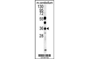 Image no. 1 for anti-OTU Domain Containing 6B (OTUD6B) (AA 234-262), (C-Term) antibody (ABIN651994)