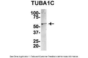 Image no. 2 for anti-Tubulin, alpha 1c (TUBA1C) (C-Term) antibody (ABIN2788514)