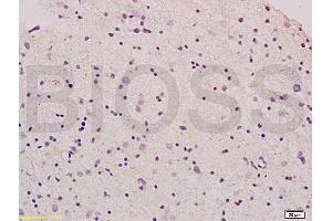 Image no. 2 for anti-Glial Cell Line Derived Neurotrophic Factor (GDNF) (AA 121-211) antibody (ABIN736536)