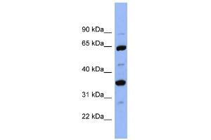Image no. 2 for anti-Serine (Or Cysteine) Peptidase Inhibitor, Clade C (Antithrombin), Member 1 (SERPINC1) (Middle Region) antibody (ABIN2776790)