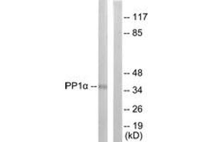 Western Blotting (WB) image for anti-Protein Phosphatase 1, Catalytic Subunit, alpha Isoform (PPP1CA) (AA 281-330), (pThr320) antibody (ABIN1531470)