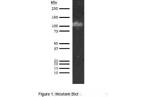 Image no. 1 for anti-ADAM Metallopeptidase with Thrombospondin Type 1 Motif, 13 (ADAMTS13) antibody (ABIN5566846)