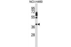 Image no. 2 for anti-Forkhead Box D1 (FOXD1) antibody (ABIN2997954)