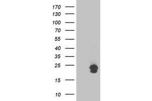 Image no. 1 for anti-Transmembrane Emp24 Protein Transport Domain Containing 1 (TMED1) antibody (ABIN1501414)