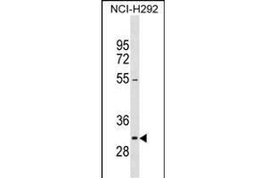 NIFK 抗体  (C-Term)
