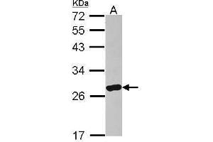 WB Image Sample (30 ug of whole cell lysate) A: IMR32 12% SDS PAGE antibody diluted at 1:500