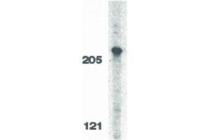 Image no. 2 for anti-CASP8 Associated Protein 2 (CASP8AP2) (C-Term) antibody (ABIN6655104)
