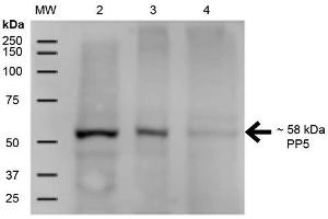 Image no. 1 for anti-Protein Phosphatase 5, Catalytic Subunit (PPP5C) antibody (Alkaline Phosphatase (AP)) (ABIN2868709)