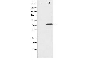 Image no. 1 for anti-Microphthalmia-Associated Transcription Factor (MITF) (pSer180), (pSer73) antibody (ABIN6255037)