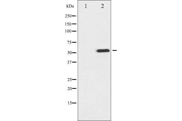 anti-Microphthalmia-Associated Transcription Factor (MITF) (pSer180), (pSer73) antibody