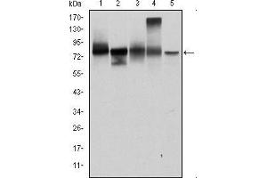 Image no. 4 for anti-Junction Plakoglobin (JUP) antibody (ABIN969225)
