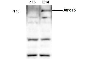 Image no. 2 for anti-Lysine (K)-Specific Demethylase 5B (KDM5B) (Internal Region) antibody (ABIN6657904)