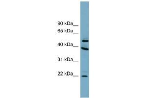 Image no. 1 for anti-Chromosome 4 Open Reading Frame 20 (C4orf20) (Middle Region) antibody (ABIN2787124)