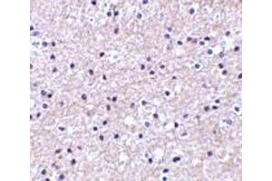 Image no. 1 for anti-Immediate Early Response 3 (IER3) (Center) antibody (ABIN499960)
