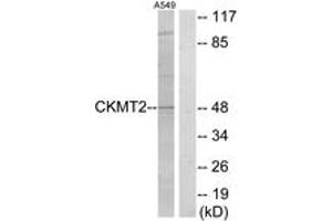 Image no. 1 for anti-Creatine Kinase, Mitochondrial 2 (Sarcomeric) (CKMT2) (AA 231-280) antibody (ABIN1533635)