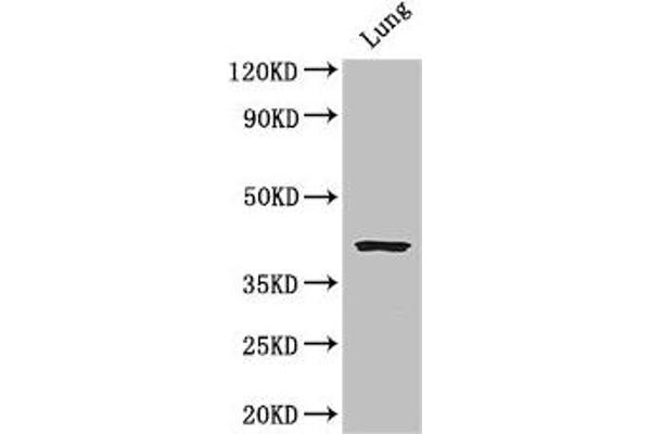 CysLTR1 antibody  (AA 298-337)