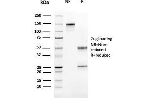 Cathepsin K anticorps  (AA 163-274)