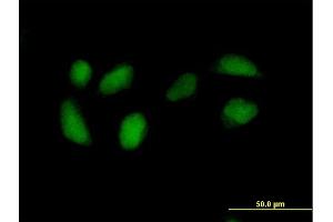 Immunofluorescence of purified MaxPab antibody to RPE on HeLa cell.