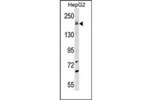 Image no. 1 for anti-Patatin-Like phospholipase Domain Containing 6 (PNPLA6) (AA 960-990), (C-Term) antibody (ABIN953768)