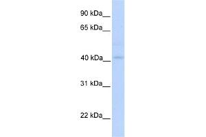 Image no. 1 for anti-Gasdermin B (GSDMB) (N-Term) antibody (ABIN2775462)