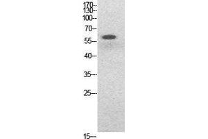 Image no. 5 for anti-Nuclear Factor-kB p65 (NFkBP65) (acLys314), (acLys315) antibody (ABIN3188030)