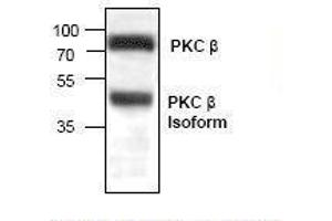 PKC Antikörper  (C-Term)