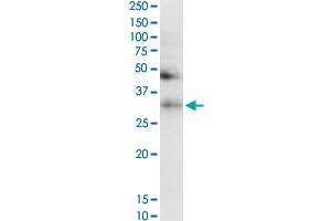 anti-Transferrin (TF) (AA 551-650) antibody
