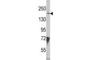 Kdm6b Antikörper  (AA 1-30)