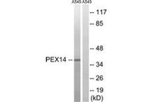 Image no. 1 for anti-Peroxisomal Biogenesis Factor 14 (PEX14) (AA 117-166) antibody (ABIN1535155)