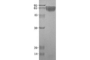 Image no. 1 for Kininogen 1 (KNG1) (Transcript Variant 2) protein (ABIN2724258)