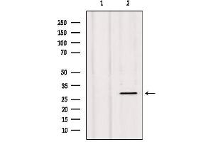 Image no. 1 for anti-Neurexophilin 1 (NXPH1) (Internal Region) antibody (ABIN6257383)