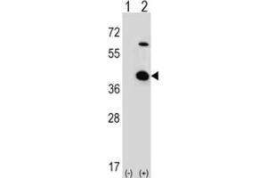 Image no. 1 for anti-Serine/threonine Kinase Receptor Associated Protein (STRAP) antibody (ABIN3001728)