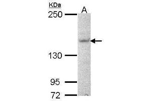 WB Image Sample (30 ug of whole cell lysate) A: NT2D1 5% SDS PAGE antibody diluted at 1:1000