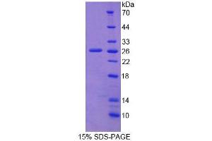 Image no. 1 for Fibulin 2 (FBLN2) (AA 858-1069) protein (His tag) (ABIN1099082)