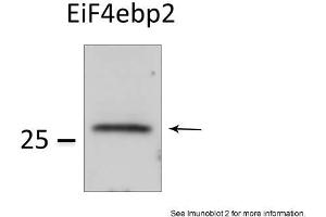 Image no. 2 for anti-Eukaryotic Translation Initiation Factor 4E Binding Protein 2 (EIF4EBP2) (N-Term) antibody (ABIN2784743)