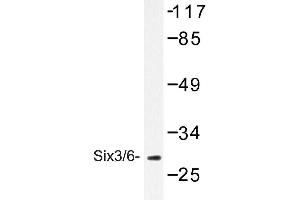 Image no. 1 for anti-Sine Oculis-Related Homeobox 3 (SIX3) antibody (ABIN272150)