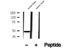 Image no. 1 for anti-Matrix Metallopeptidase 28 (MMP28) antibody (ABIN6263303)