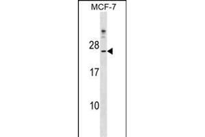 CYB5D1 Antibody (Center) (ABIN1538512 and ABIN2849260) western blot analysis in MCF-7 cell line lysates (35 μg/lane).