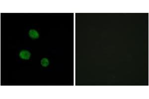 Image no. 3 for anti-Heterogeneous Nuclear Ribonucleoprotein M (HNRNPM) (AA 11-60) antibody (ABIN1533765)